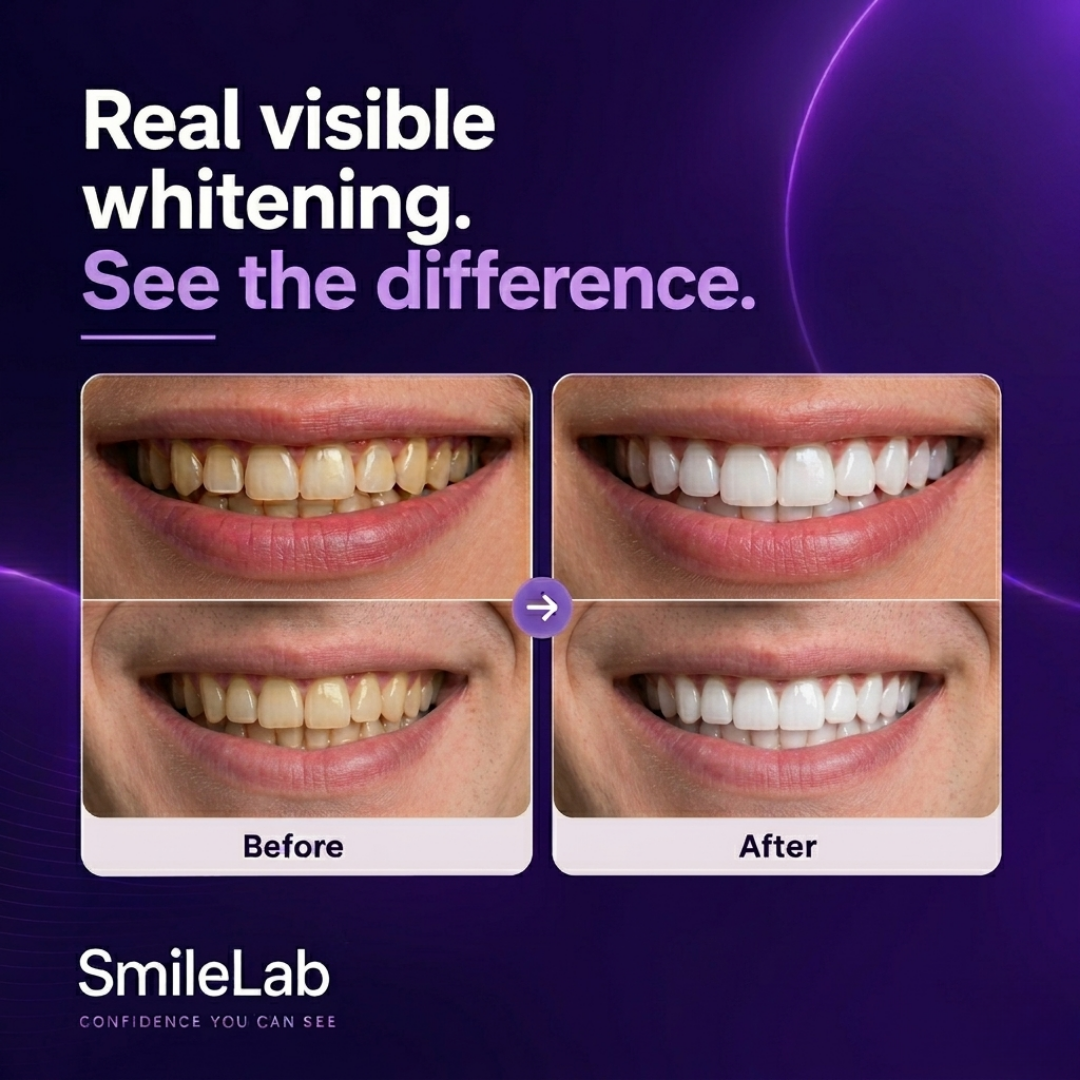 SmileLab™ Strips