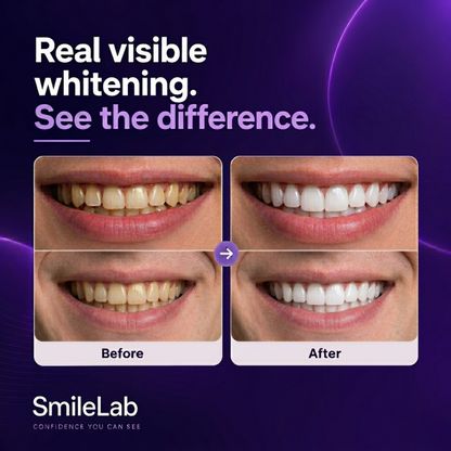 SmileLab™ Strips
